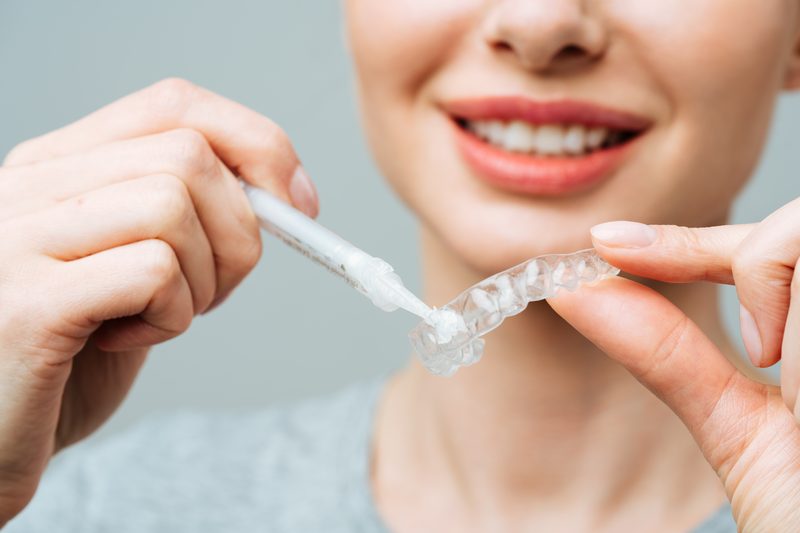 Single arch bleaching tray custom dental lab Sydney